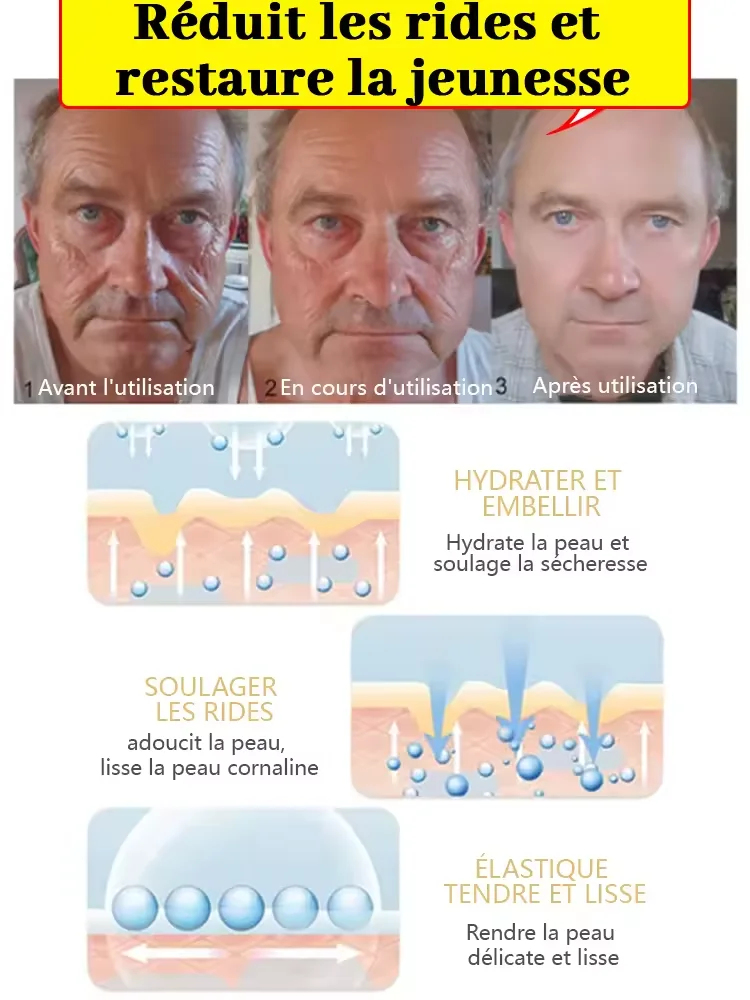 دافئ وخالي من التجاعيد في عام 2025. جلد كامل الجسم، يجلب نفسه إلى سن 18 عامًا