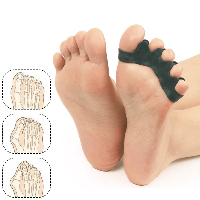 1/10Pair Black Toe Separator Thumb Valgus Bunion Adjuster Splitter Hammer Corrector Protector Foot Pain Relief Silicone Straight