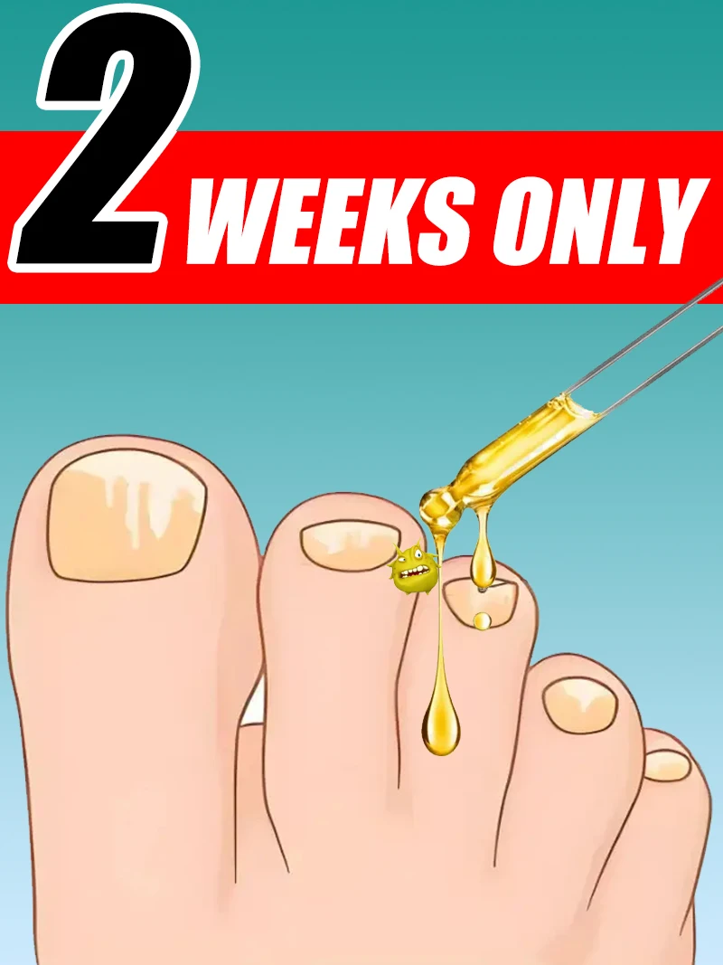 

manicure for bad Could in 2 weeks farewell