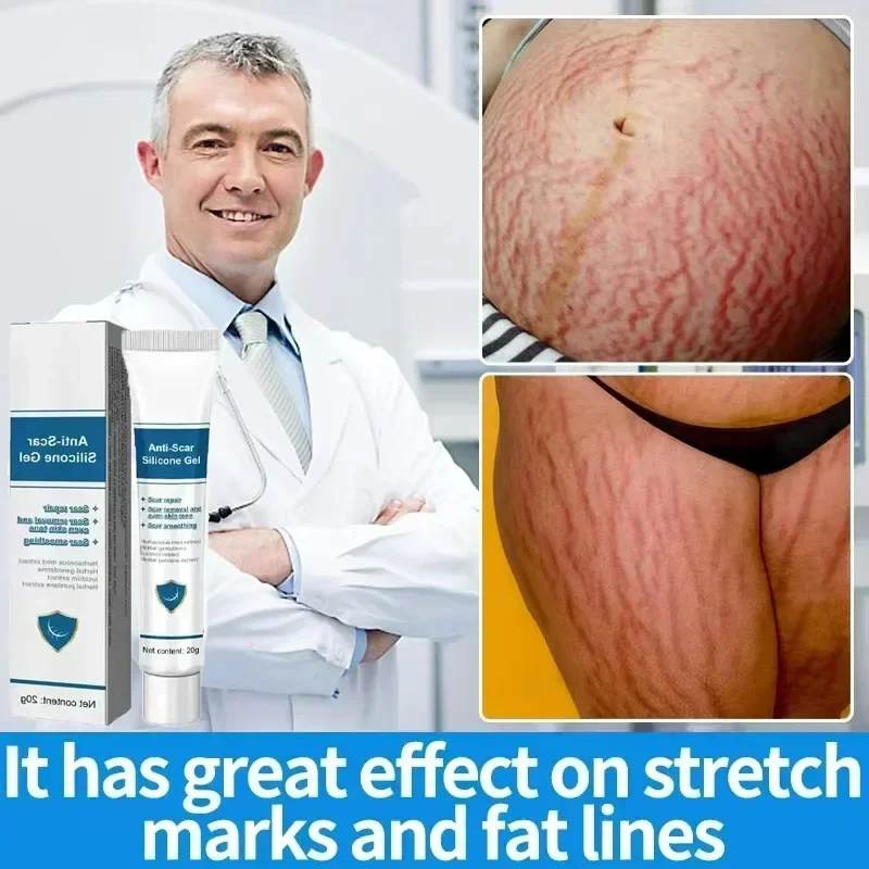 Permanent removal of stretch marks during pregnancy, eliminating stretch marks on the abdomen of the body