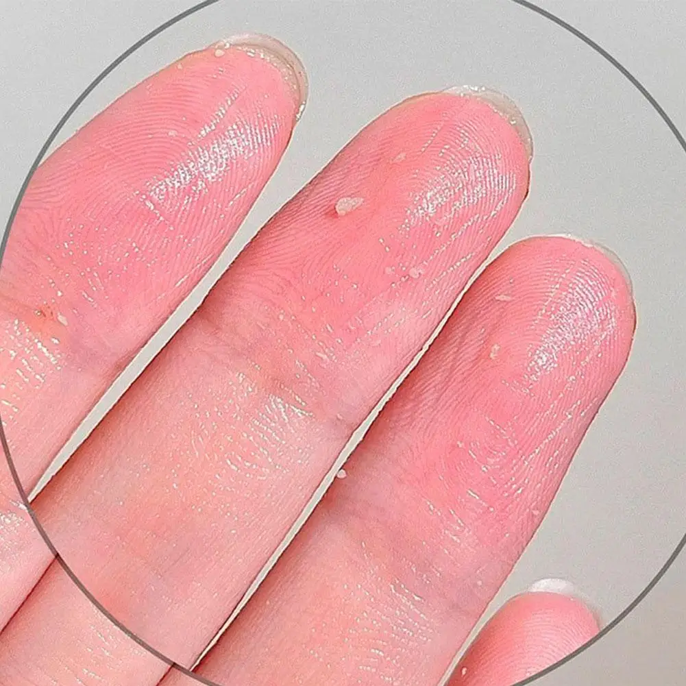 Gel exfoliante de Aloe Vera, exfoliante facial, aceite blanqueador, aceite refrescante, Control del producto corporal, CUIDADO HIDRATANTE U7X0