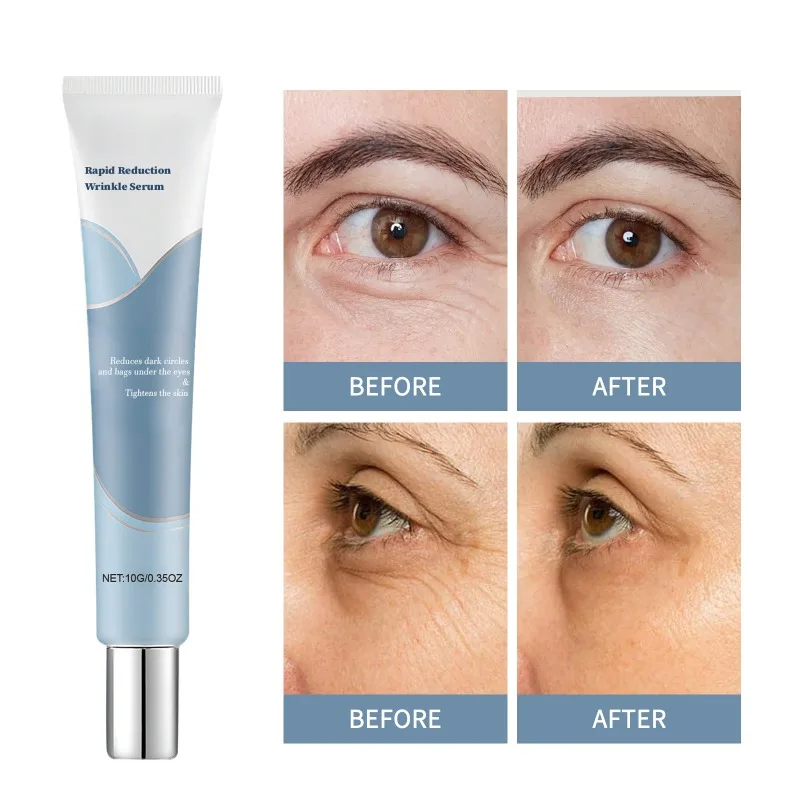 ترطيب مصل العين كريم عين تدليك السلس منطقة العين طبطب ترطيب تغذي الجلد تقليل الخطوط الدقيقة جوهر العناية اليومية بالعين