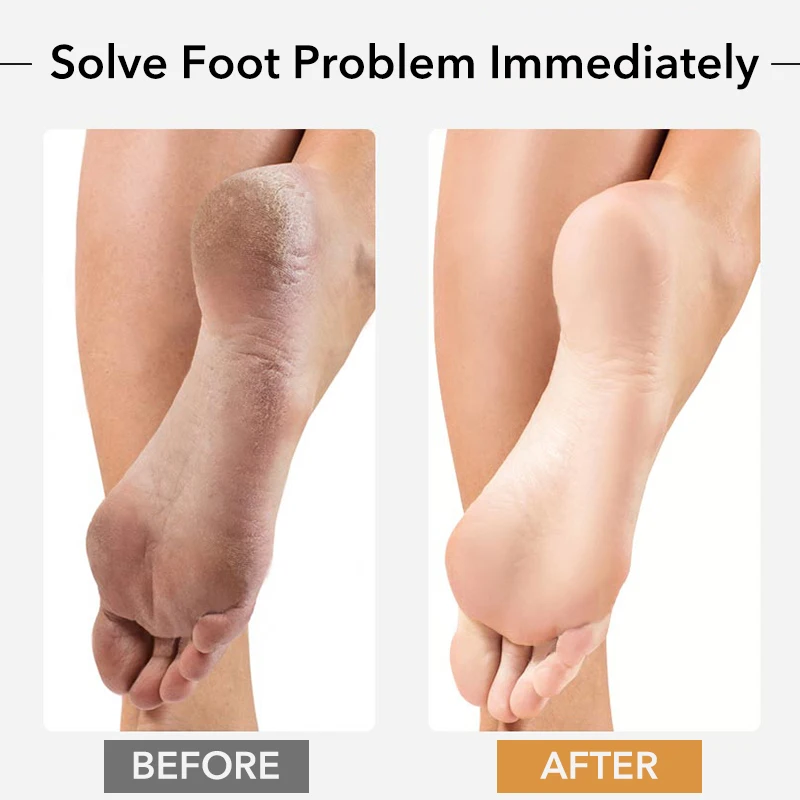 Thumbnail 3 - #29 Latest Foot Scrubbers Offers