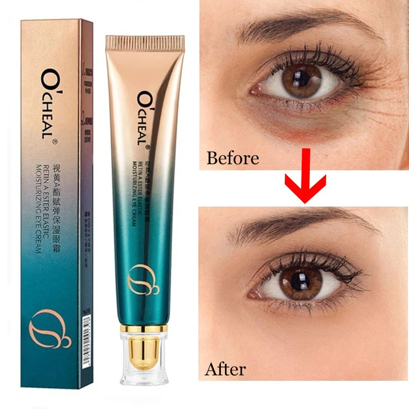 Anti-Wrinkle Eye Cream Cosmetics Anti-Aging Eye Serum Remove Eye Bags Dark Circles Puffiness Firmness Fades Crow\'s Feet Eye Care