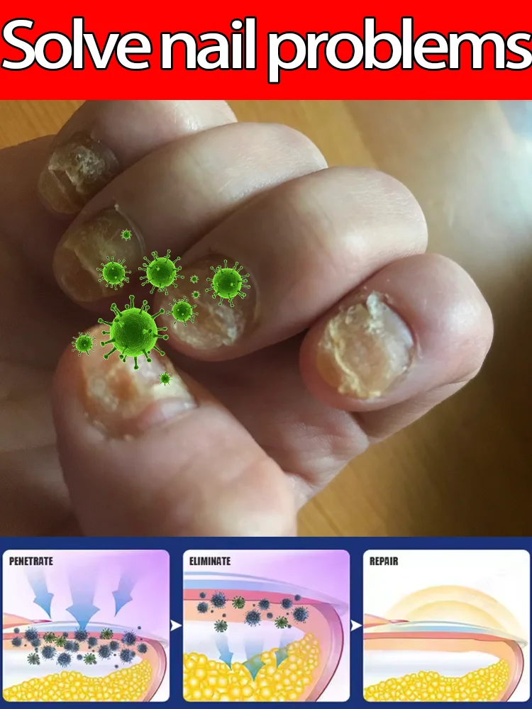 

ᵈᵉᶜᵏ on "Aurora Healing": Using plant energy to dissolve fungal shadows