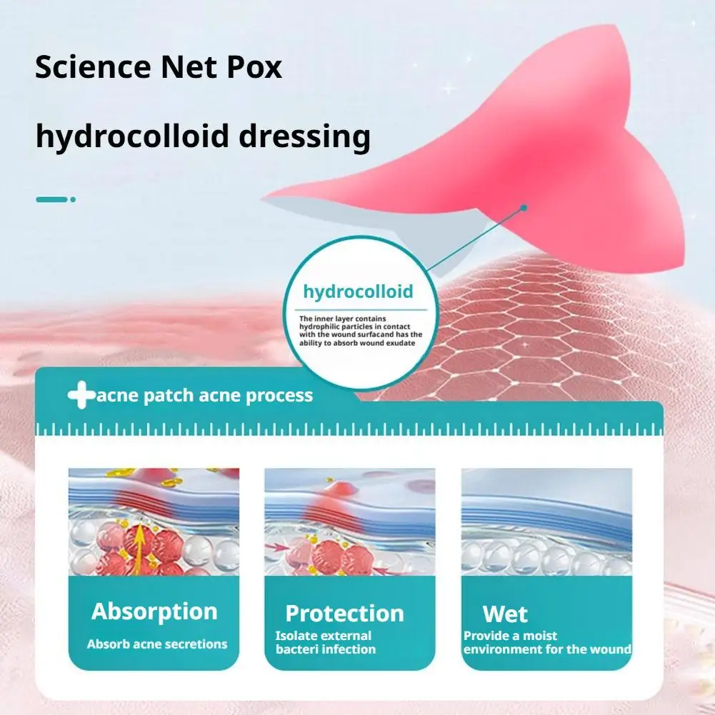 Patch d'acné en forme d'étoile, points noirs, comédons fermés, améliore la beauté de la peau des femmes, cosmétique, outils hydrocolloïdes pour l'acné