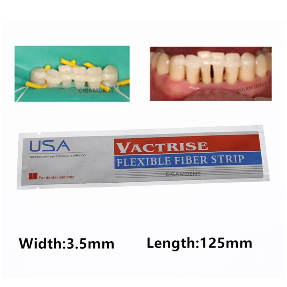 

5Pcs Dental Fiber Splint Glass Flexible Fiber Strip Composite Resin Bonding Adhesive Braided Glass Fiber Stick 3.5X125mm