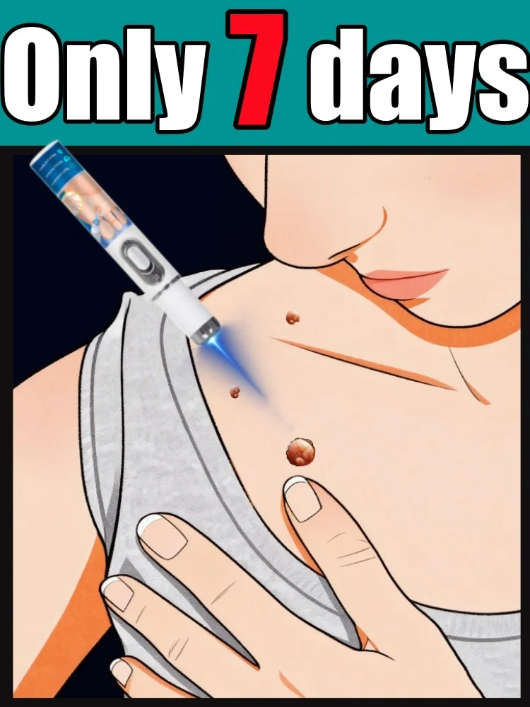 

Портативный набор ручек унисекс с высоким рейтингом 2025: попрощайтесь на бородавки