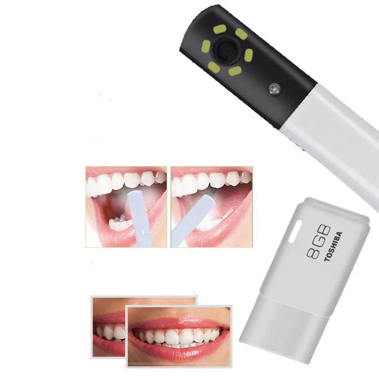 Wireless 5 Million Pixels Wifi HD  Intra Oral  Intra Scanner with 17 Inches  For  Chair Unit Use