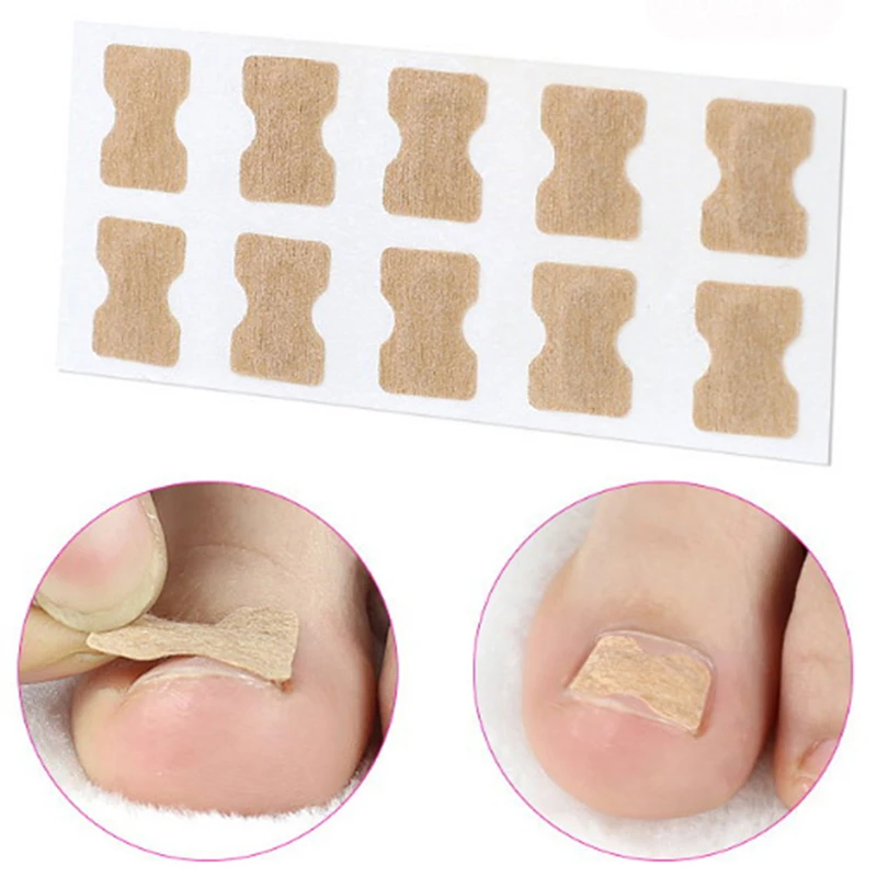 10Pcs/Set Ingrown Toenail Correction Patch Toenail Brace Pedicure Tool