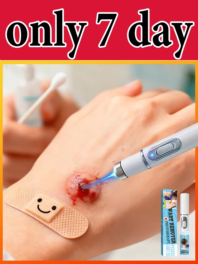 

Gᴇɴᴇʀᴀᴛɪᴏɴ-3 Lᴀsᴇʀ Sᴀʏs Gᴏᴏᴅʙʏᴇ Tᴏ Wᴀʀᴛs Iɴ 7 Dᴀʏs