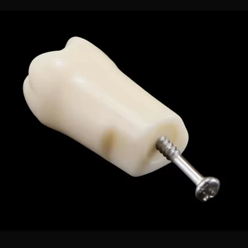 

28/32pcs Dental Typodont Teeth Model Removable Individual Screw-in Resin Training Aid Denture Practice Replacement Tooth