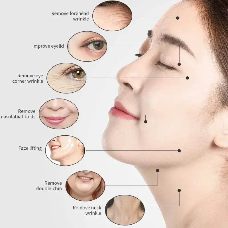 Dispositivo de belleza RF 3 en 1, máquina de estiramiento de la piel tripolar, elimina las arrugas del cuello y los ojos, doble mentón, estiramiento facial, estiramiento de la piel, adelgazamiento corporal