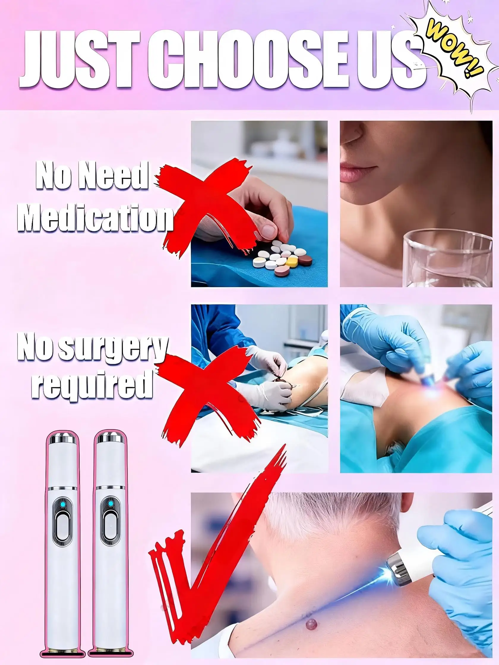 Laser pen point application wart removal