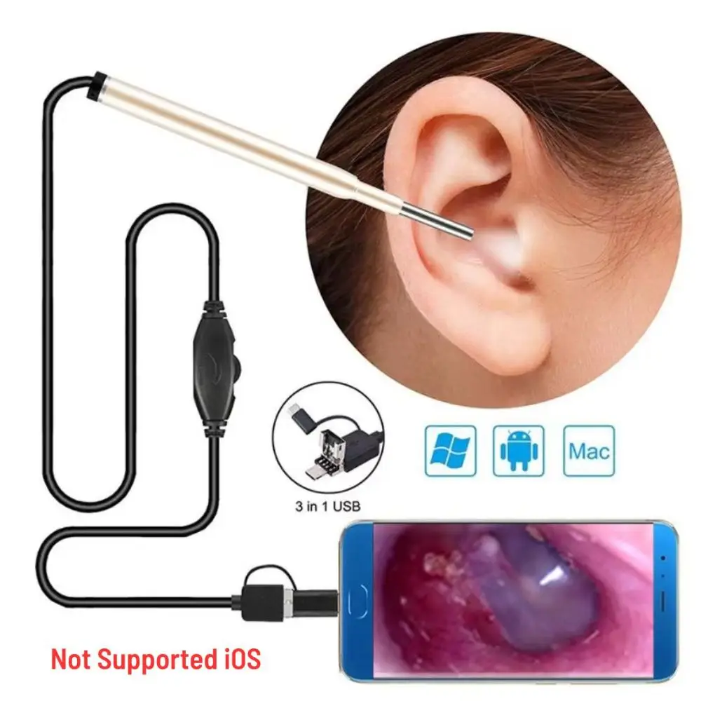 

3 in 1 USB Visual Ear Cleaning Endoscope 3.9mm 720P HD Otoscope Ent Inspection Camera with 6 LED Lights, Support Android and PC