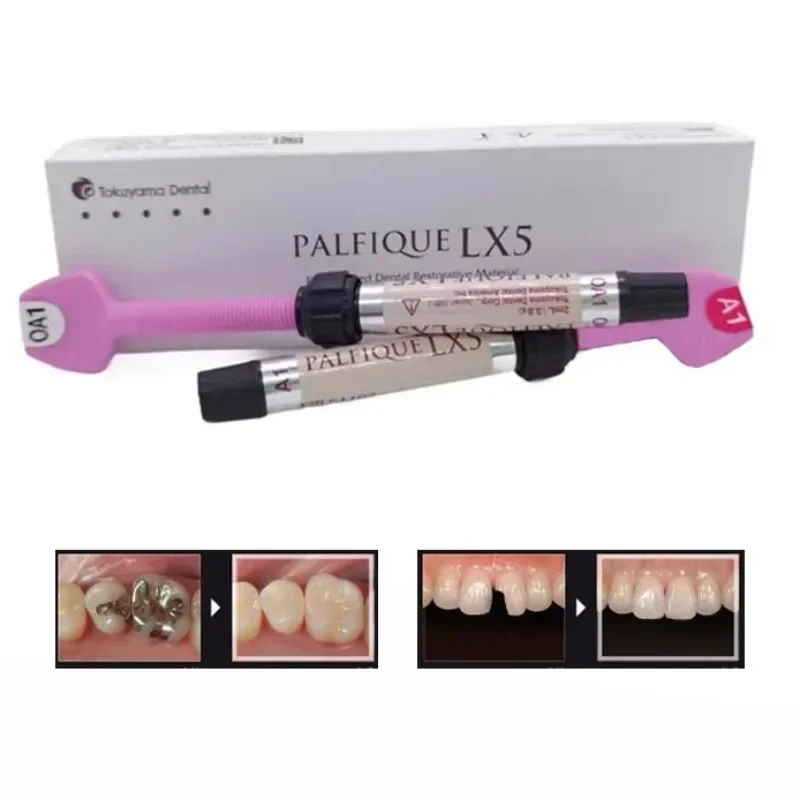 Materiale per il ripristino del riempimento del trattamento dentale autoadesivo universale in resina composita LX5 fotopolimerizzabile 2,0 ml (3,8 G)