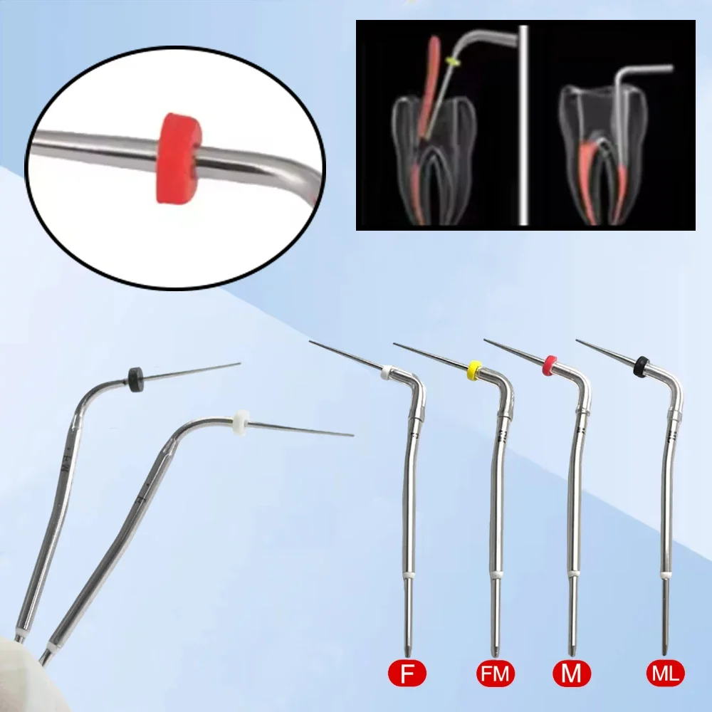 4 Piece Heat Carrier Pluggers Compatible with Buchanan Type B System for Gutta Percha Vertical Condensation Obturation