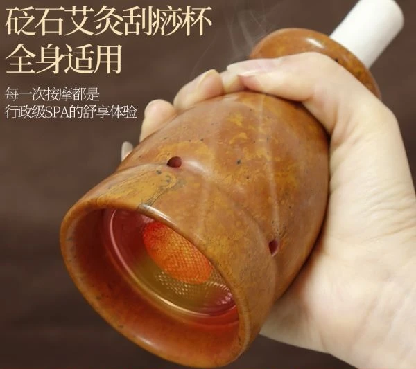 

Authentic Sibin Fugui Red Bianshi Moxibustion Jar Household Back Cervical Massage Moxibustion Beauty Salons Same Scraping Cup