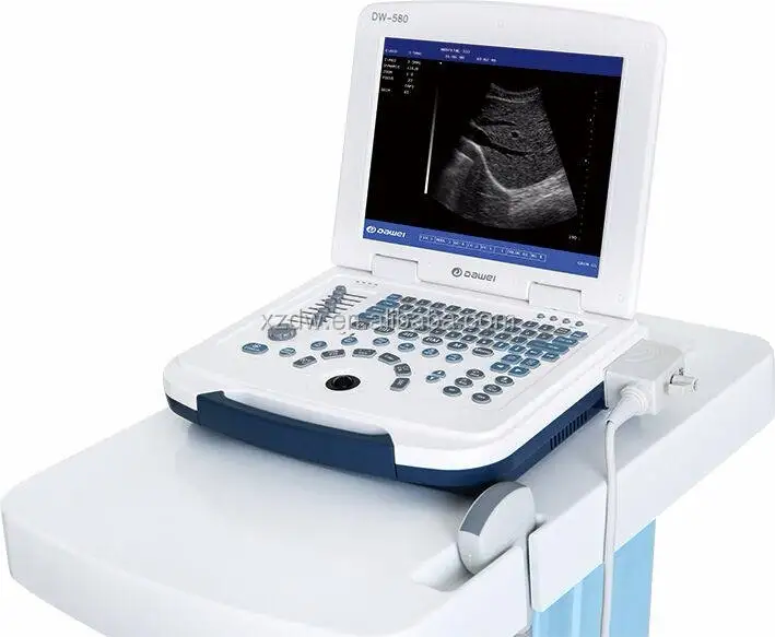 Hot selling Portable Diagnostic sonography & ultrasonography ultrasound scanner & portable handheld laptop ultrasound