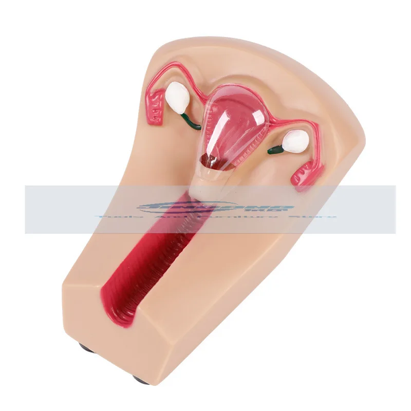 Female Intrauterine Contraceptive Device Model IUD Training Simulator Brand