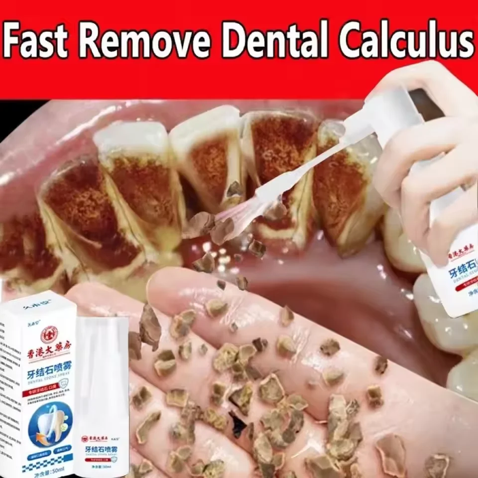 

Dental Calculus Remover Teeth Whitening Spray Toothpaste Cleaning Oral Hygiene Removal Halitosis Plaque Stains Fresh Breath Care