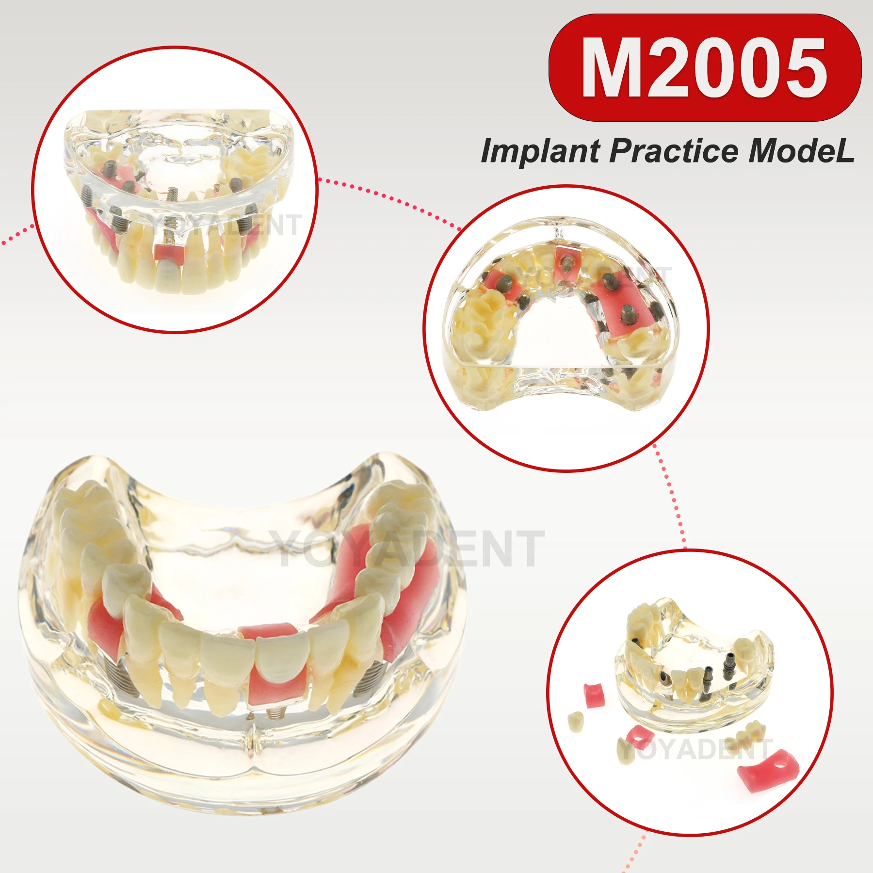 

Модель стоматологической смолы с имплантатом, обучающая модель моста для изучения стоматологических товаров Demo M2005