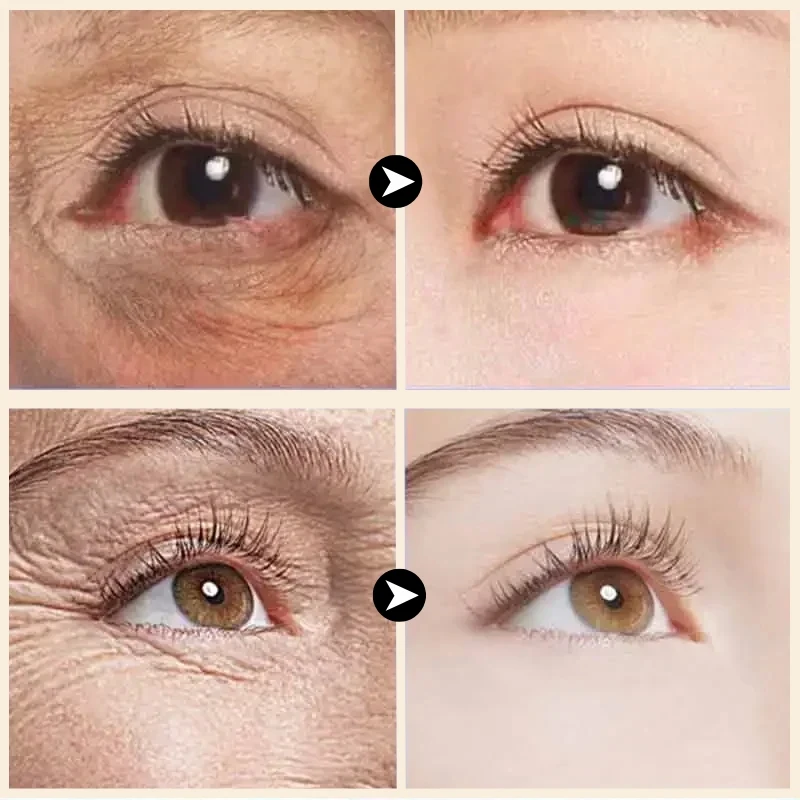 Retinol Eye Cream Stick Firming Repair Improves Elasticity Reduces Puffiness Fine Lines Sunken Areas Tear Trough Eyes Care Cream