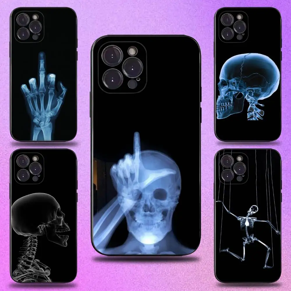 

Radiological Human Skeleton Phone Case For iPhone 16,15,14,13,12,11 Plus,Pro Max,XS,X,XR,SE,Mini,8,7,Soft Silicone Black Cover