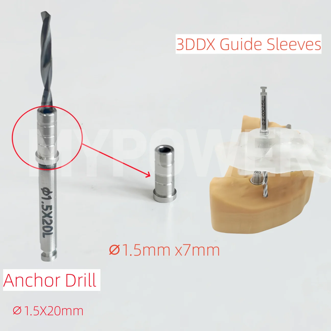 

Dental 3DDX Guided Anchor Pin Sleeves Guided Anchor Drill Digital Implant Guided Template Fixation 1.5