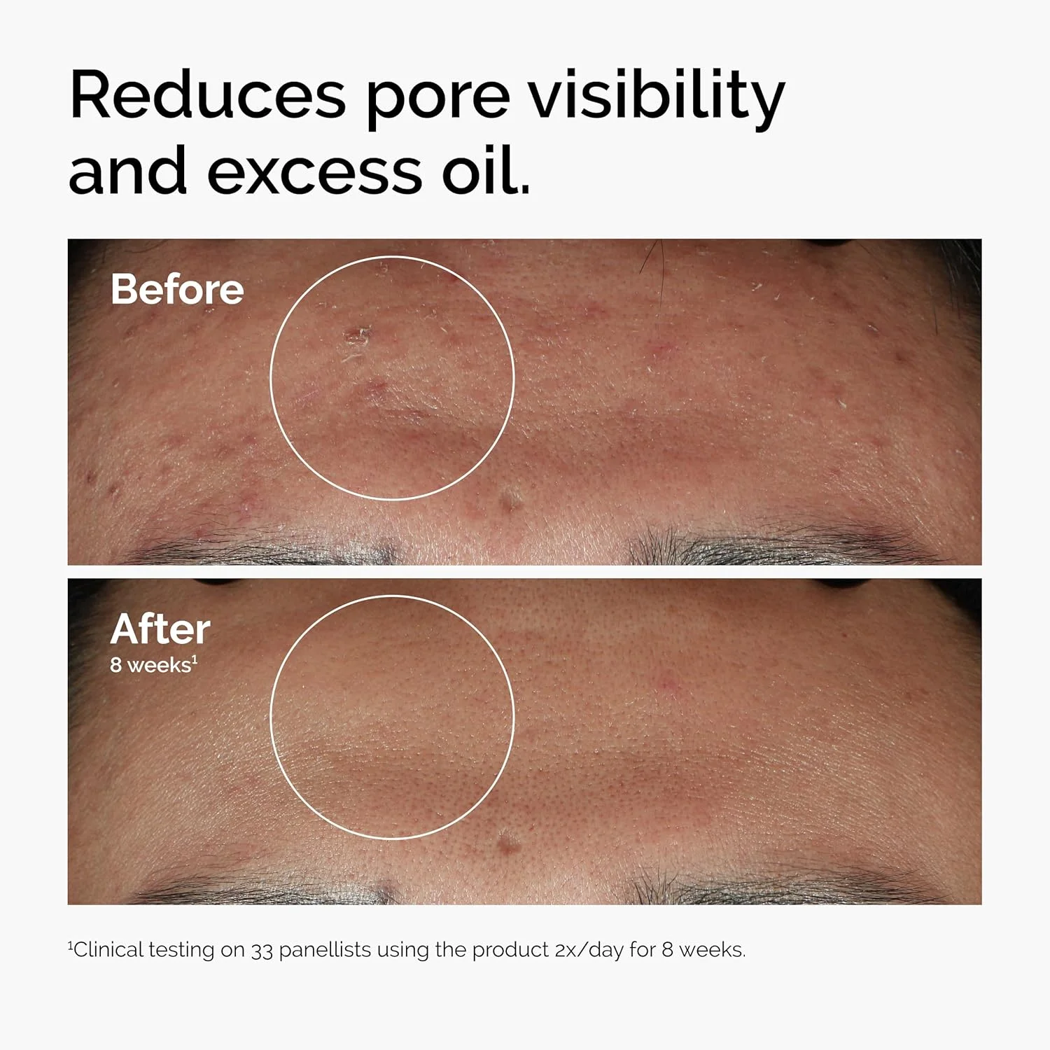 30 مل من 10% نياسيناميد + 1% زنك، مناسب للمصل الناعم على الجلد المضاد للمشاكل، مناسب لكل من الرجال والنساء