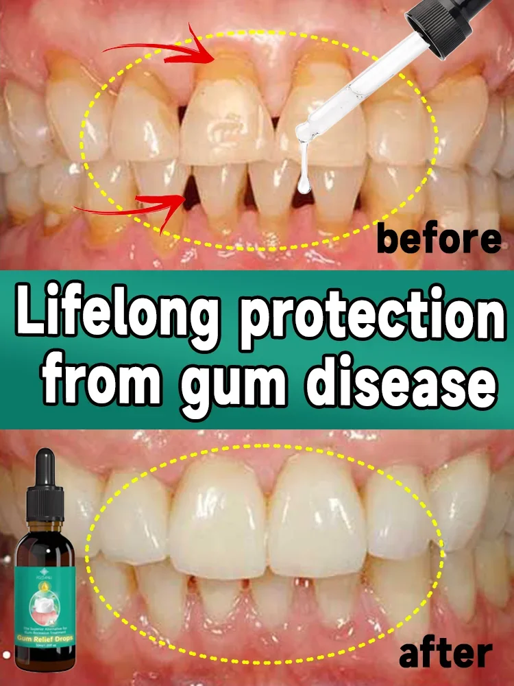 Repariert effektiv geschädigtes Zahnfleisch, lindert Zahnschmerzen, repariert das Zahnfleisch und stärkt das Zahnfleisch