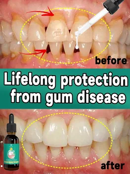 Repariert effektiv geschädigtes Zahnfleisch, lindert Zahnschmerzen, repariert das Zahnfleisch und stärkt das Zahnfleisch