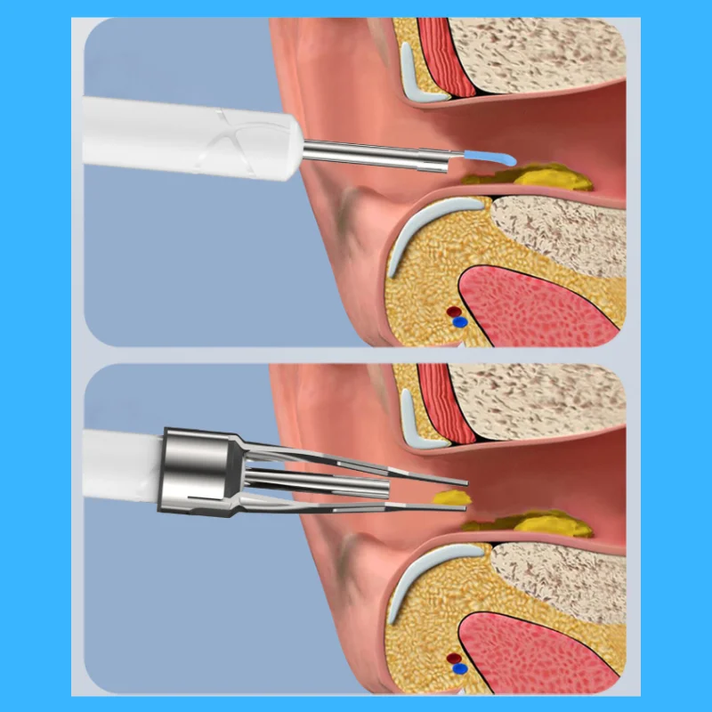 

Совок для ушей для домашнего использования, 3,5 мм, 720P, инструмент для удаления ушной серы, умный Wi-Fi, видимый свет для мобильного телефона Android