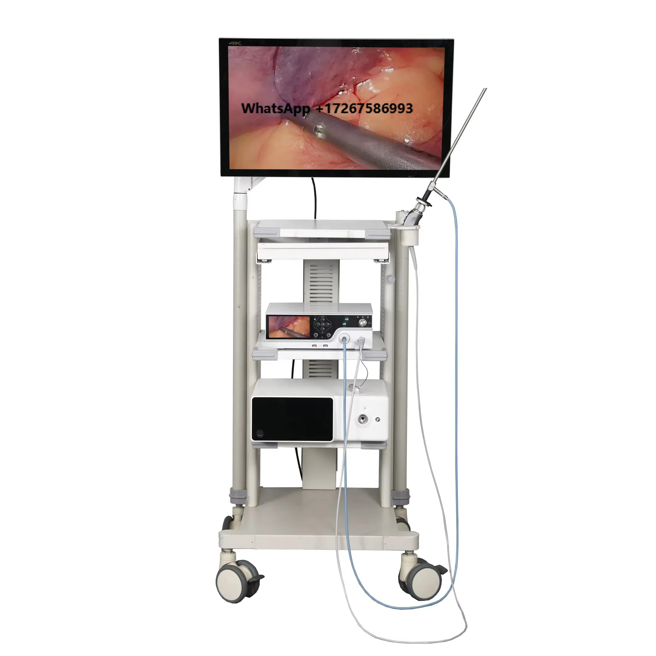 Tuyou 3-in-1 Veterinary Endoscopy Medical Imaging Equipment Endoscope for General Surgery Laparoscopy