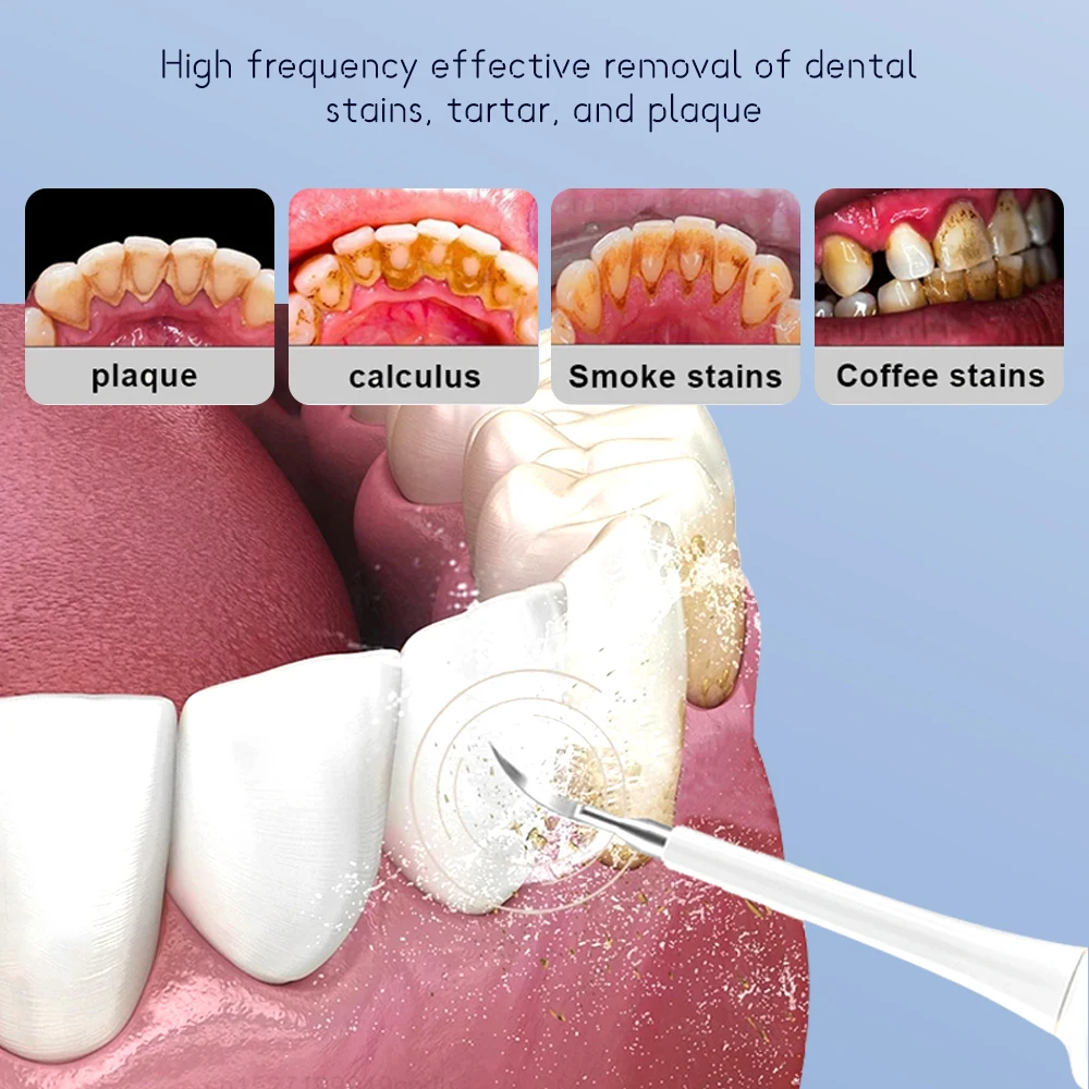 Cepillo de dientes eléctrico recargable, instrumento de blanqueamiento, resistente al agua, USB, Sónico, dispositivo de carga rápida