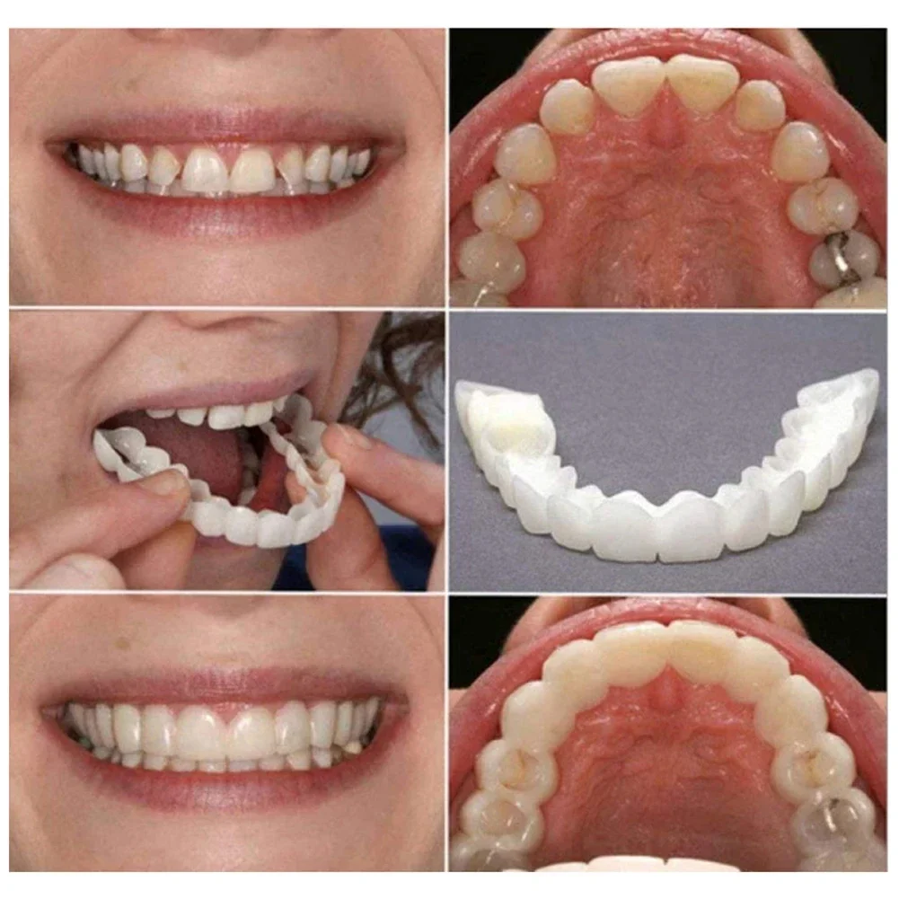 1-5 مجموعة الأسنان وهمية طقم أسنان التجميل العلوي السفلي المؤقتة صالح ابتسامة القشرة كاذبة الأسنان هدفين غطاء العلوي كاذبة غطاء الأسنان المفاجئة