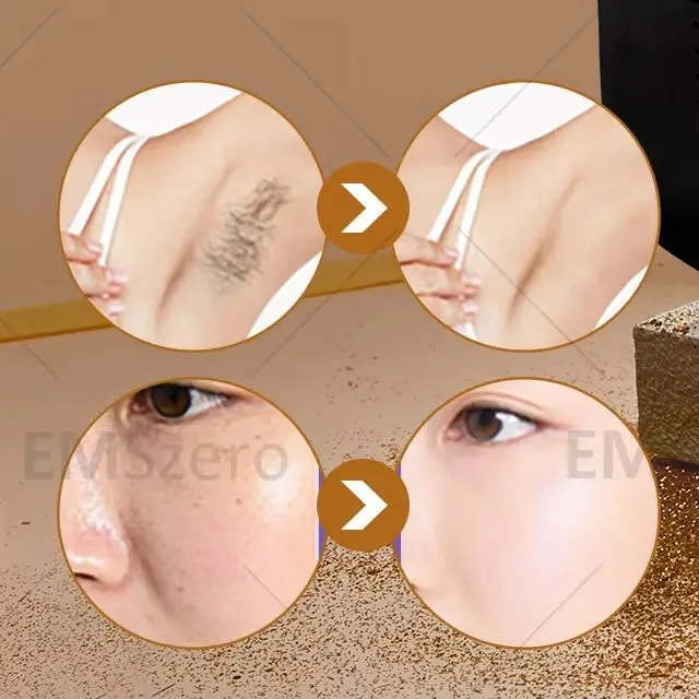 

2IN1 Diode Laser Hair Removal Machine 3 Wavelengths Picosecond Laser Tattoo Removal 4500W Painless Beauty Salon Equipment