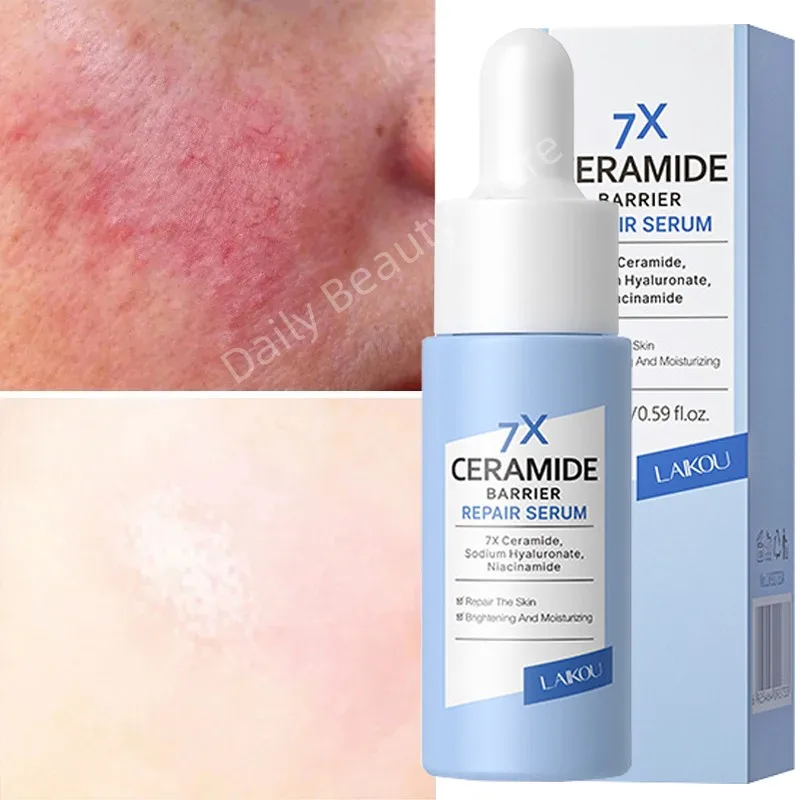 Repair Facial Redness Serum Effective Soothing Sensitive Skin Fast Treatment Redness Rosacea Itching Moisturizer Korean Cosmetic