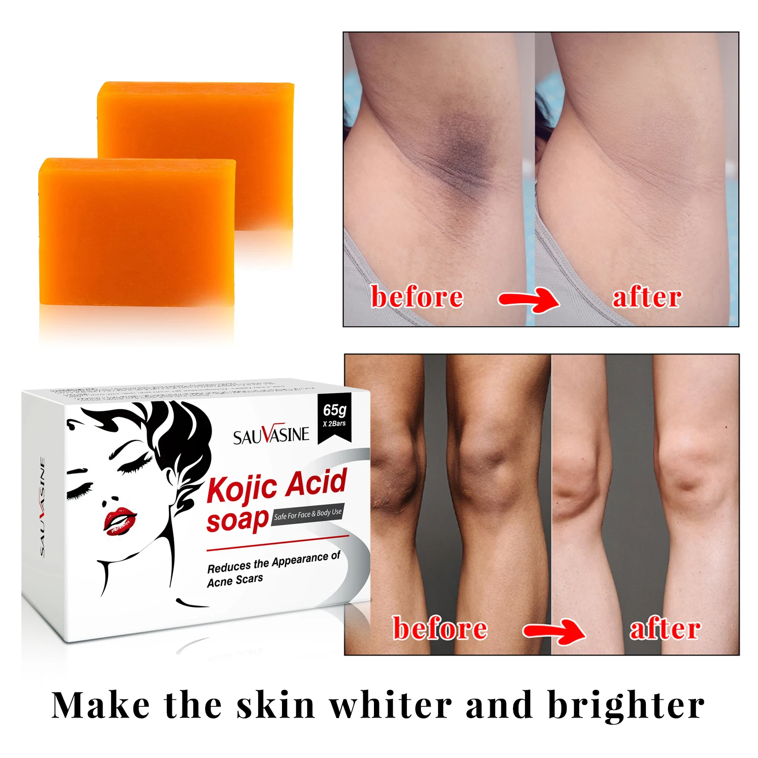 Sabonete clareador facial ácido kójico, clareamento da pele, tom de pele igual, óleo de limpeza profunda, cuidados com a pele hidratante, saúde beleza, 65g x 2