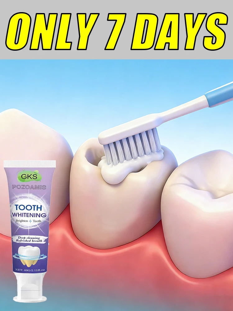 

Dᴏɴ'ᴛ ʟᴇᴛ ᴄᴀᴠɪᴛɪᴇs ɢᴇᴛ ᴡᴏʀsᴇ; ʀᴇᴘᴀɪʀ ᴄᴀᴠɪᴛɪᴇs ᴀɴᴅ ᴡʜɪᴛᴇɴ ʏᴏᴜʀ ᴛᴇᴇᴛʜ.