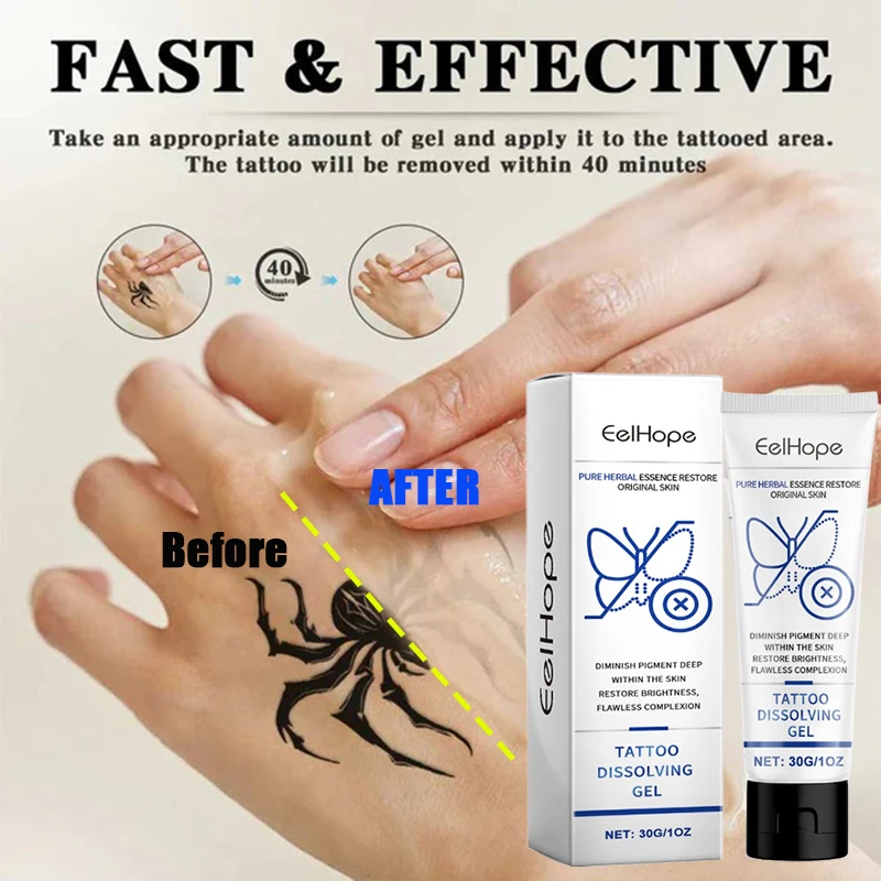 

Tattoo removal gel gently removes permanent Body tattoo care skin reduces deep pigmentation
