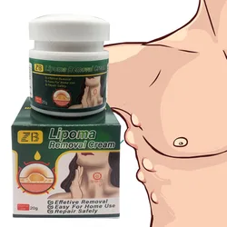 ZB 20g Pure Natural Chinese Herbal Lipoma Removal Cream Efficiently Removes Lipoma Fibroids Subcutaneous Lumps Body Health Care