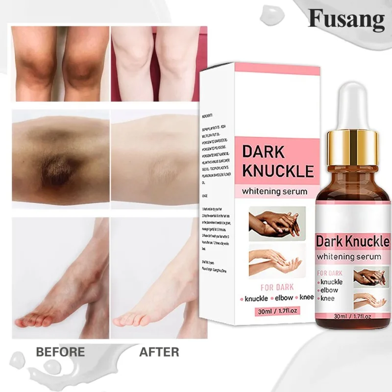 

Armpit Knuckles Whitening Essence Butt Lighten Dark Skin Serum Intimate Area Body Brighten Lotion Bleaching Private Parts Serum