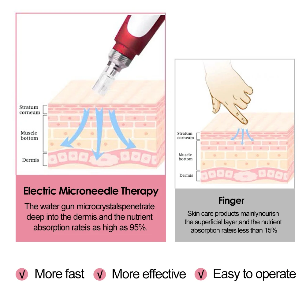 Dr Pen Ultima N2 Wired 12 Cartridge Bayonet Microneedling Derma Pen Professional Facial MTS Skin Care Beauty Microneedles