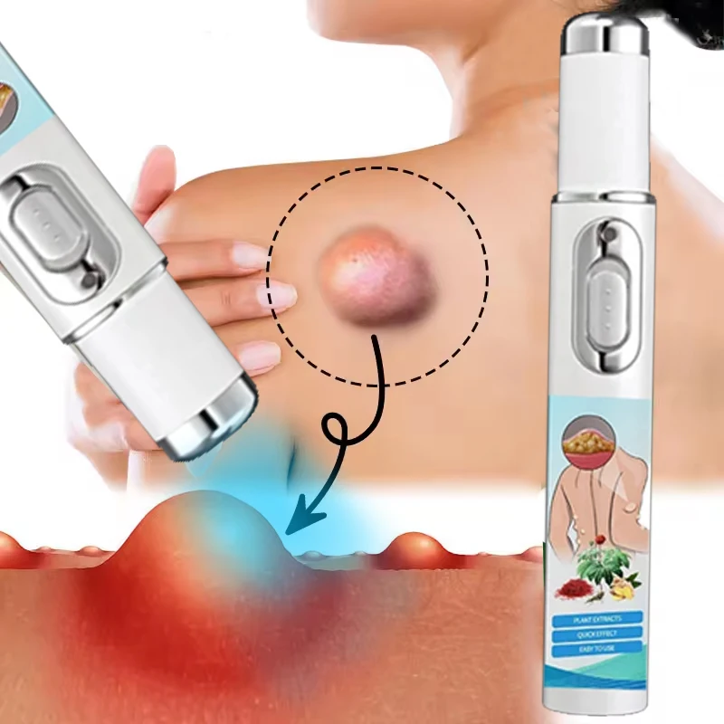 

Lipoma Removal Laser Pointer Efficiently Removes Lipoma Fibroids Subcutaneous Lumps Body Health Care