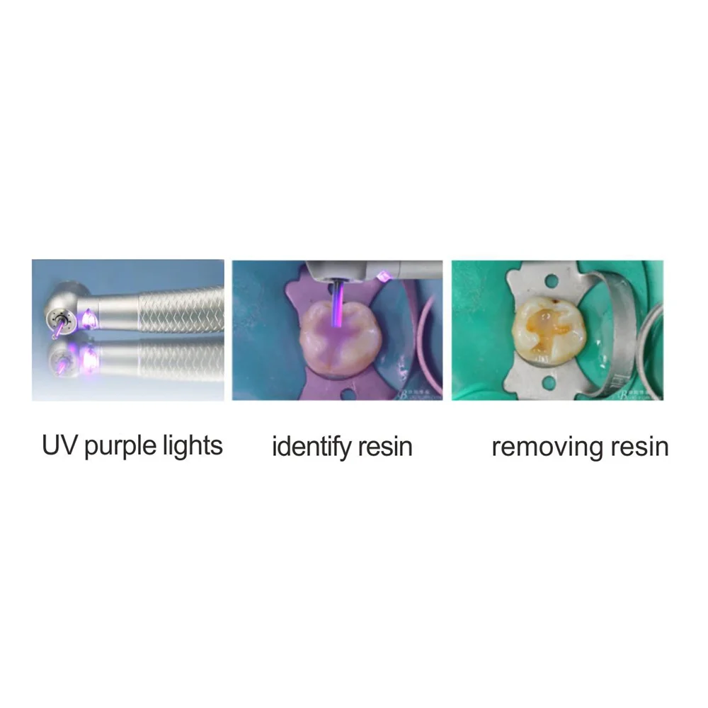 Dental High Speed Handpiece Surgical UV Purple Light Caries Detection Handpiece E-generator Air Turbine Handpiece 2/4 Holes