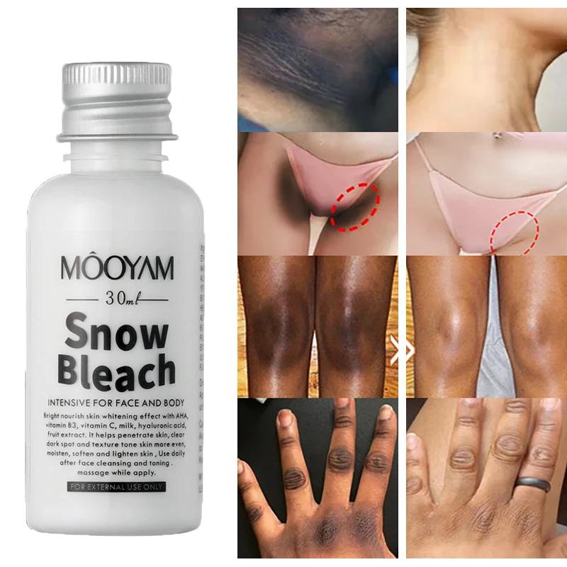 Private Body Whitening Cream Armpit Buttock Nipple Lighten Essential Remove Underarm Knee Bleach Private Parts Brighten Lotion