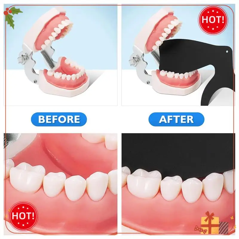 ABLE- التصوير الفوتوغرافي داخل الفم، 6 قطع من أدوات التباين للصور، مجموعة التصوير الفوتوغرافي داخل الفم