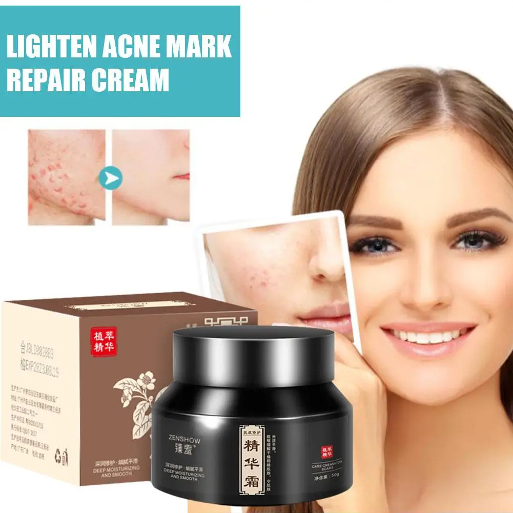 Crema para eliminar pecas, Corrector de manchas oscuras, ilumina la pigmentación, aclara la edad, Melasma, aclara la marca, blanquea el acné, E3S9, 50g