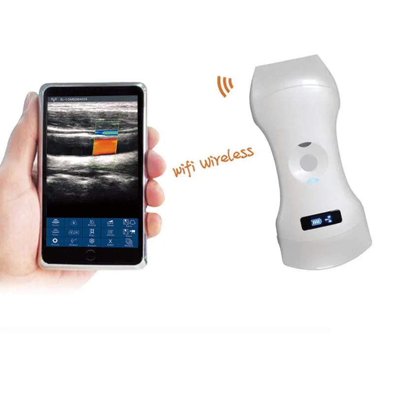 cheap price wireless medical wholesale high resolution display handheld ultrasound scanner portable ultrasound device